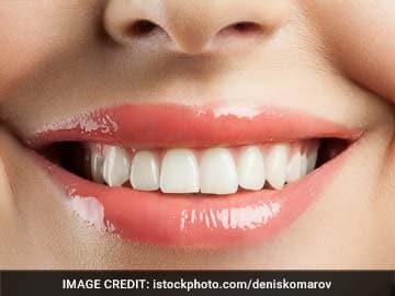 Bad breath (Halitosis)