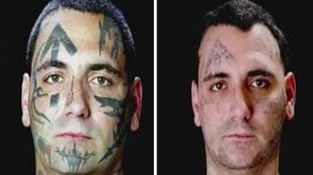 Video : Reformed skinhead removes tattoos