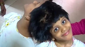 Hospital asks conjoined twins to shift out