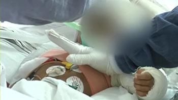 Video : Have never seen such a case, say doctors treating baby abused relentlessly