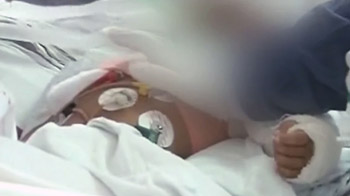 फलक की ब्रेन सर्जरी, पुलिस को मिले सुराग