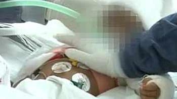Video : Baby Falak shows new infections, doctors unsure of survival