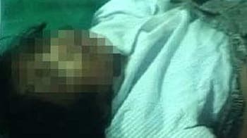 Video : Mumbai: 7-yr-old girl branded with hot spoons