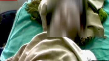 Video : झांसी में बलात्कार पीड़ित ने खुद को आग लगाई