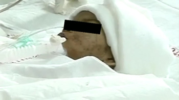 बेबी फलक की हालत में सुधार, वार्ड में शिफ्ट हुई