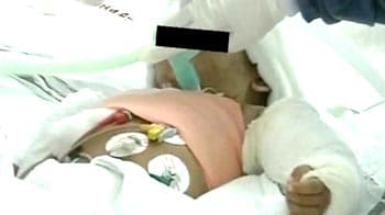 Baby Falak has survived, declare doctors
