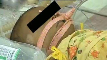 पिता ने 3 महीने की बच्ची को पीटा