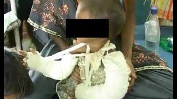 Videos : सिगरेट से कई बार जलाई गई बेबी शिरीन