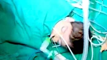 Videos : सीने से जुड़ी बहनों का ऑपरेशन सफल रहा