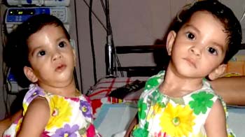 जन्म से जुड़ी अराधना-स्तुति की ऑपरेशन के बाद पहली तस्वीरें