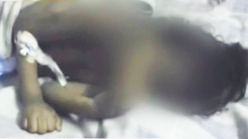 बच्ची की हड्डियां तोड़ी, मां के पास जाने की जिद की थी बच्ची की हड्डियां तोड़ी, मां के पास जाने की जिद की थी