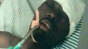 Video : African student beaten, stoned in Jalandhar; in coma for 3 months