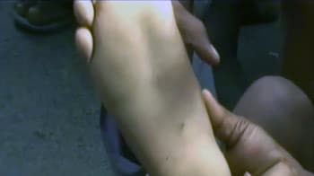 Videos : बिहार : जेडीयू नेता ने बच्चे के तलवे में कील घुसाई