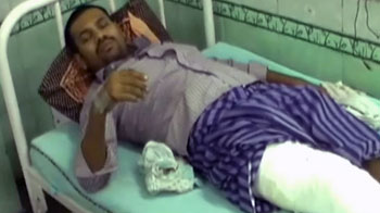 Videos : दिल्ली : बदमाशों की पिटाई से व्यापारी का पैर टूटा