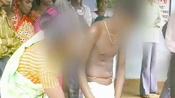 आठवीं के छात्र को सीनियरों ने ब्लेड-लाठियों से पीटा