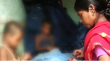 तेजाब सोखती सांसें और बंधक बचपन!