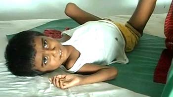 How malnutrition and Encephalitis are connected