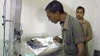 रिक्शाचालक की एक महीने की बच्ची दामिनी वेंटिलेटर पर