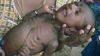 Congress' ad controversy: Lankan refugees or Gujarat malnourished?