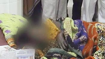बलात्कार की कोशिश के बाद जिंदा जलाया