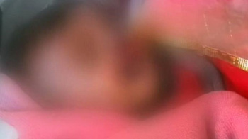 In Bikaner, father bites off his baby's nose, lips and cheeks in a fit of rage