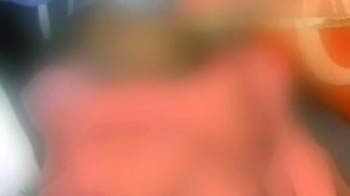 बाप की हैवानियत की शिकार बच्ची का सफल ऑपरेशन