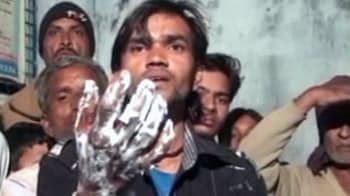 Video : 15 people dip hands in hot oil to prove loyalty