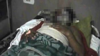 Man's head pushed into furnace for refusing to pay 'policemen'