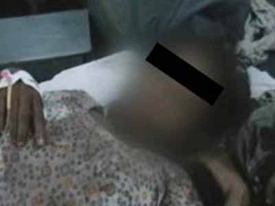 UP: Rape survivor's parents allege kin of accused tried to cut off her tongue