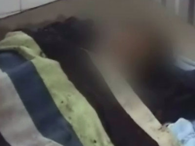 मप्र में महिला पर फेंका तेजाब