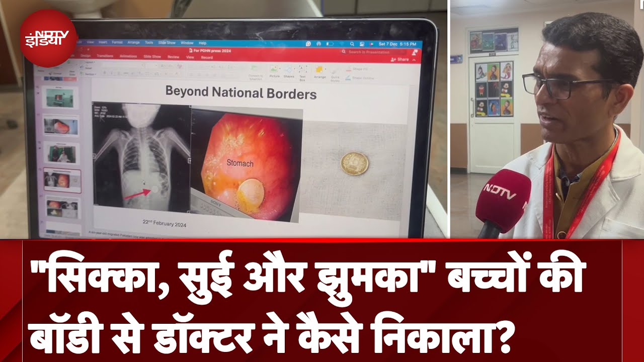 Pakistan से भारत आए 6 साल के बच्चे ने खाया 5 रू का सिक्का, Doctor ने बिना Operation कैसे बचाई जान?