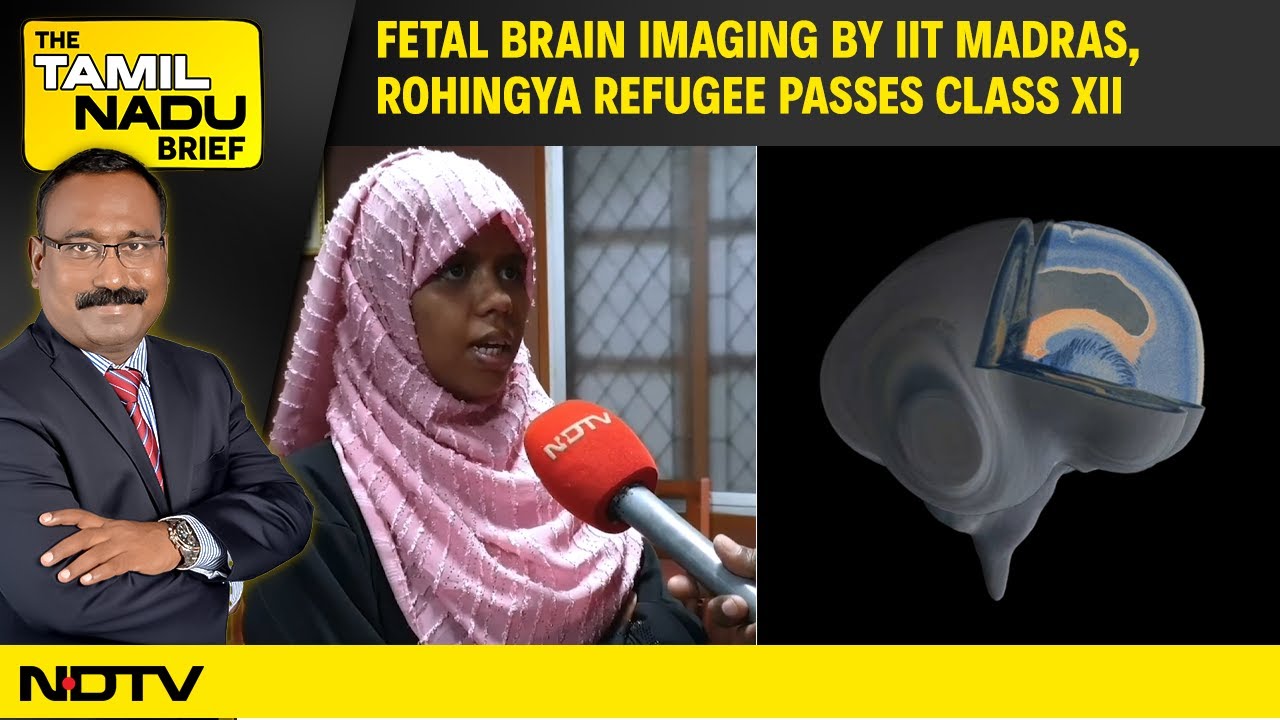 Video : Fetal Brain Imaging By IIT Madras, Rohingya Refugee Passes Class XII