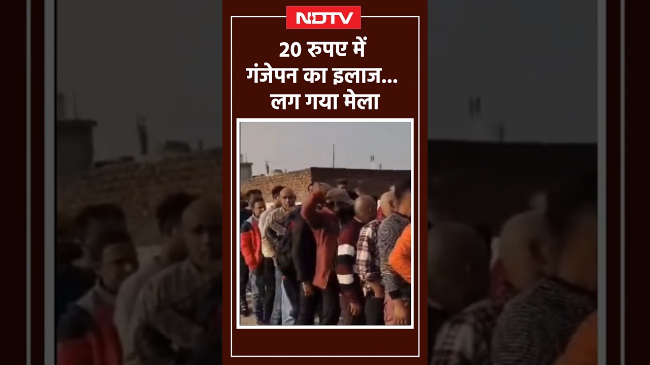 सिर्फ 20 रुपये में गंजेपन का इलाज, भीड़ देख उड़ जाएंगे होश | Viral Video | UP News | Shorts | NDTV