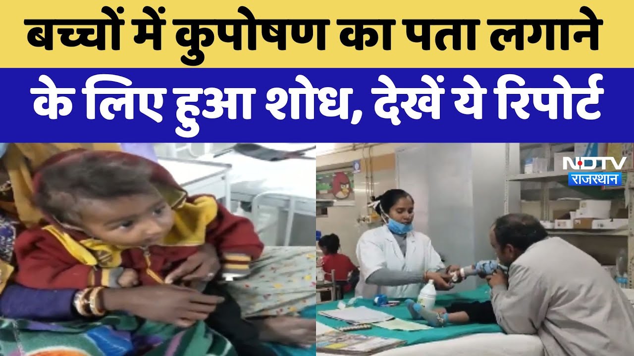 Child Malnutrition: बच्चों में कुपोषण का पता लगाने के लिए हुआ शोध, देखें ये Report