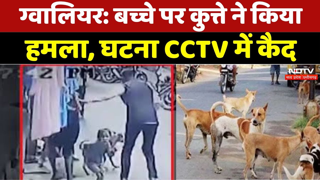 बच्चे पर कुत्ते ने किया हमला, घटना CCTV में कैद