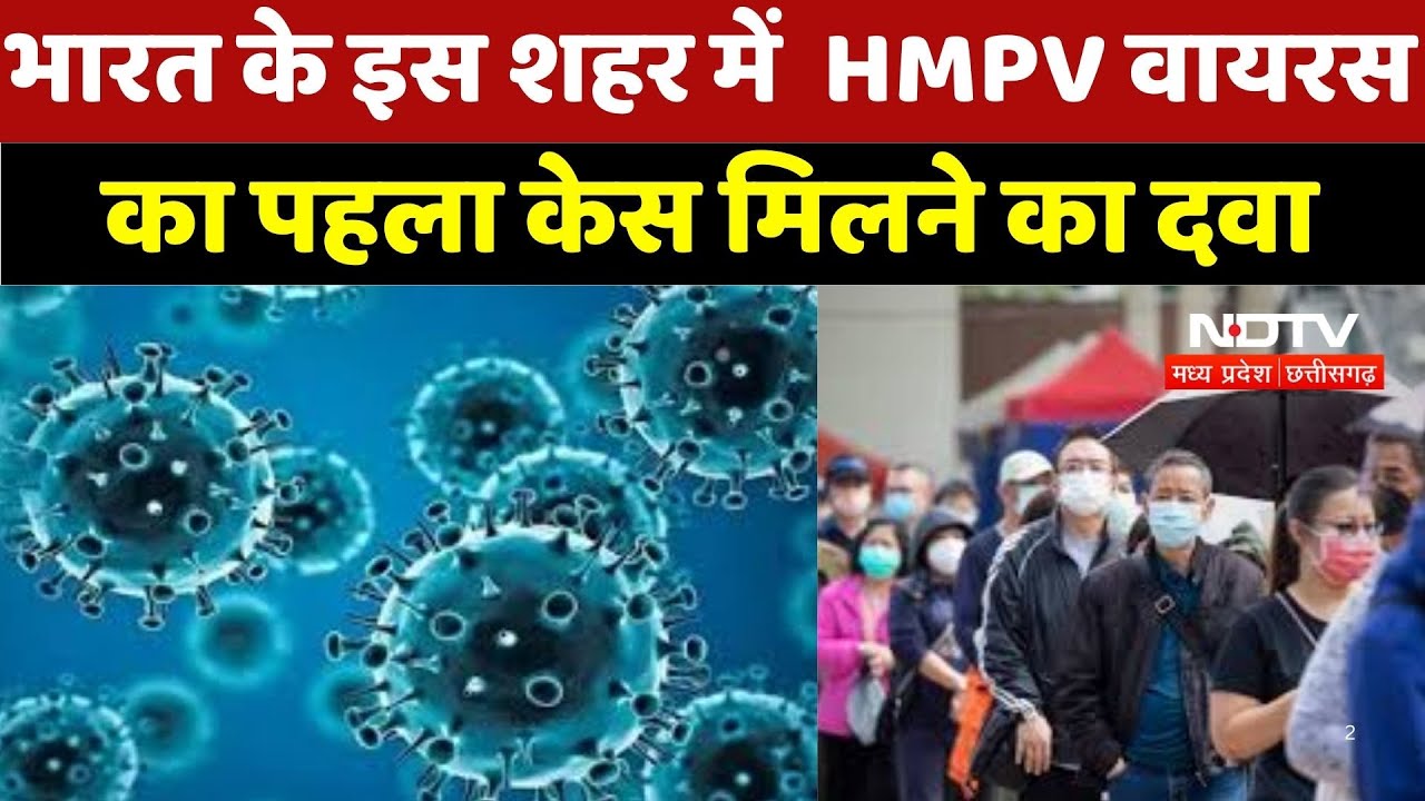 HMPV Virus : India  के इस शहर में  HMPV वायरस  का पहला केस मिलने का दवा