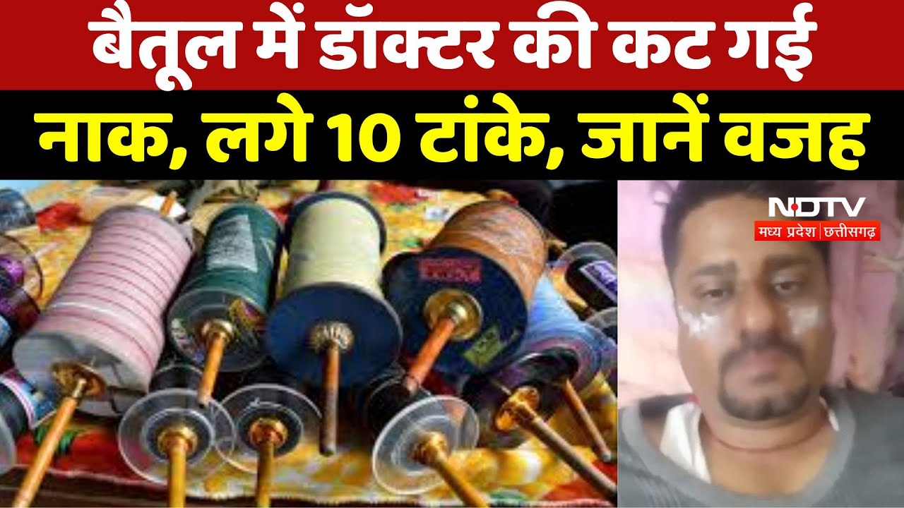 Chinese Manjha Ban : Betul में Doctor की कट गई नाक, लगे 10 टांके, जानें वजह
