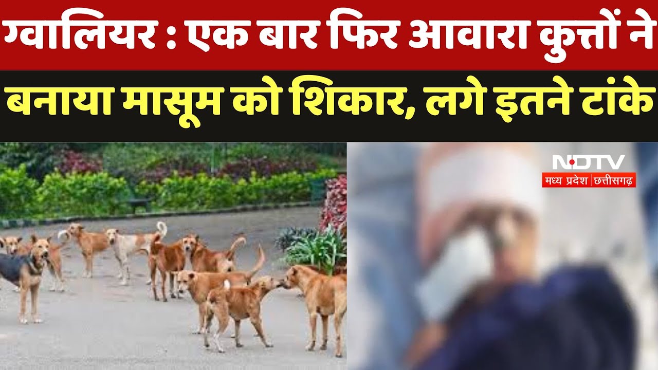 Dog Attack in Gwalior : एक बार फिर आवारा कुत्तों ने बनाया मासूम को शिकार, लगे इतने टांके