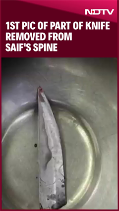 Saif Ali Khan Stabbed: 1st Pic Of Part Of Knife Removed From Saif's Spine Saif Ali Khan Stabbed: 1st Pic Of Part Of Knife Removed From Saif's Spine