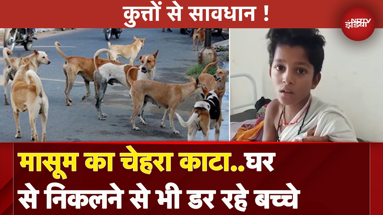 Dog Attack: कुत्तों के आतंक से खौफ में जनता, घर से निकलने से भी डर रहे बच्चे | MP