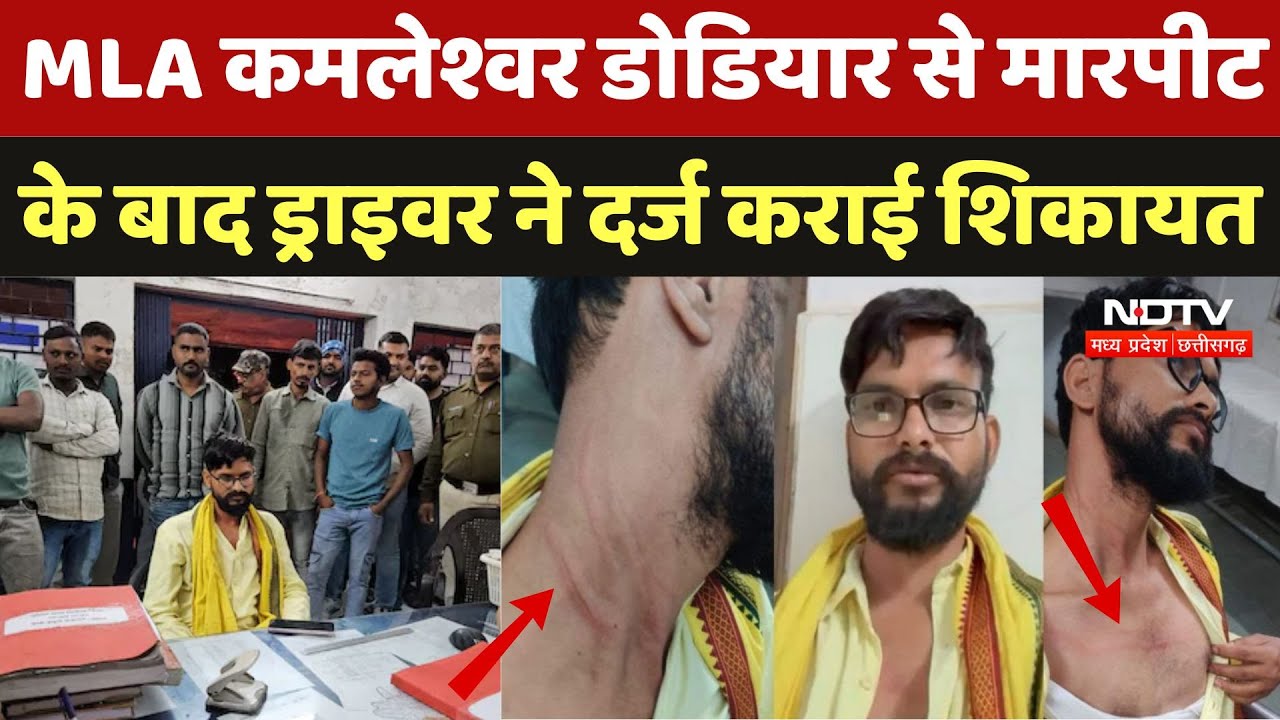 MLA Kamleshwar Dodiyar से मारपीट के बाद ड्राइवर ने दर्ज कराई शिकायत | Ratlam | BAP | Viral Video
