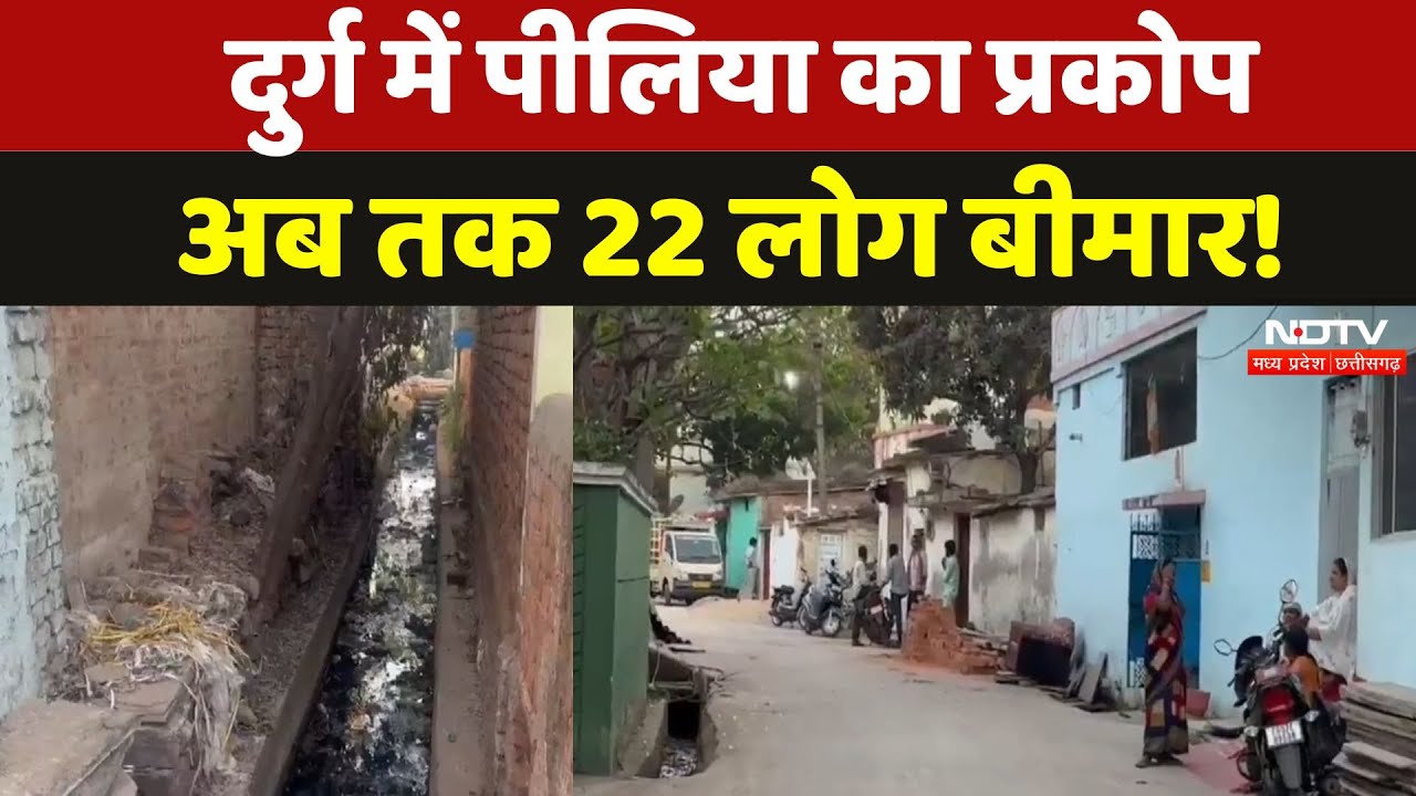 Durg News: पीलिया के चपेट में कैसे आया दुर्ग? अब तक 22 मरीजों की हुई पुष्टि | CG  | Latest News