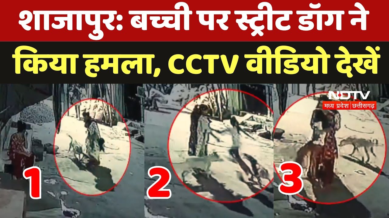 Shajapur: बच्ची पर Street Dog ने किया हमला, CCTV Video देखें