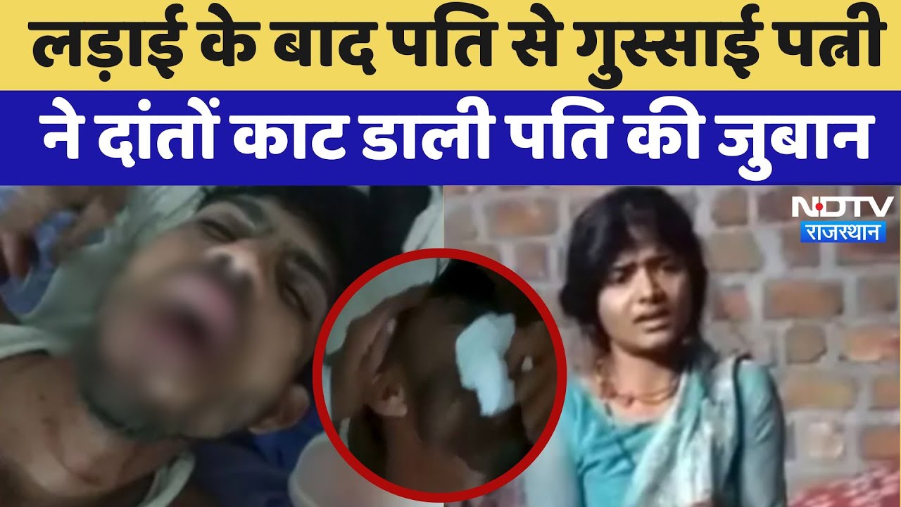 Jhalawar News: लड़ाई के बाद गुस्साई पत्नी ने दांतों से काटकर अलग कर दी पति की जुबान | Crime News Jhalawar News: लड़ाई के बाद गुस्साई पत्नी ने दांतों से काटकर अलग कर दी पति की जुबान | Crime News