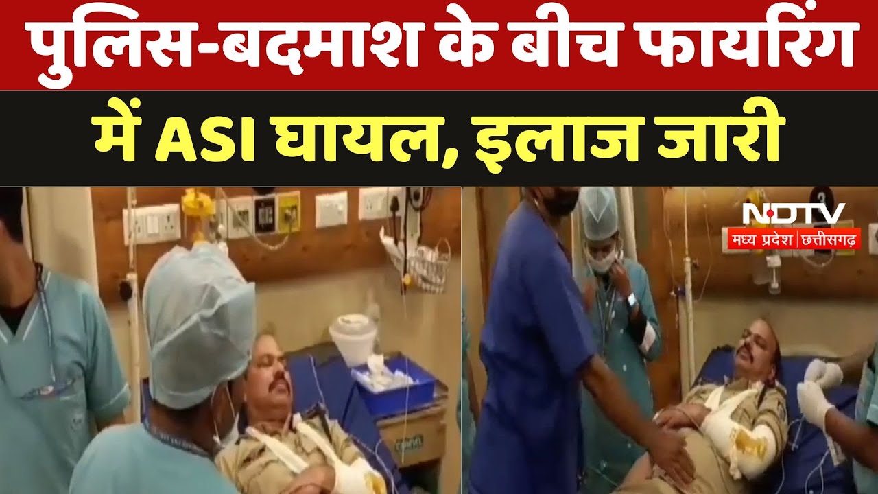 Damoh News : पुलिस-बदमाश के बीच Firing में ASI घायल, इलाज जारी