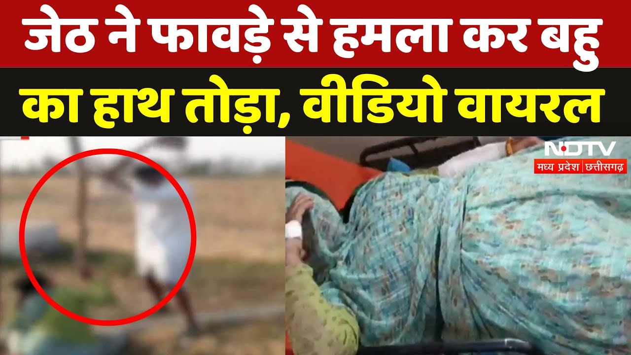 Dewas News: जेठ ने बहु पर फावड़े से हमला कर हाथ तोड़ा, बेटा भी घायल | Viral Video | MP | Latest News