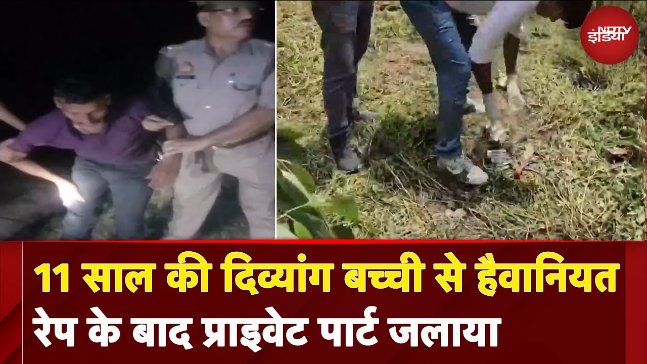 UP के Rampur में 11 साल की दिव्यांग बच्ची से हैवानियत, रेप के बाद प्राइवेट पार्ट जलाया | UP News