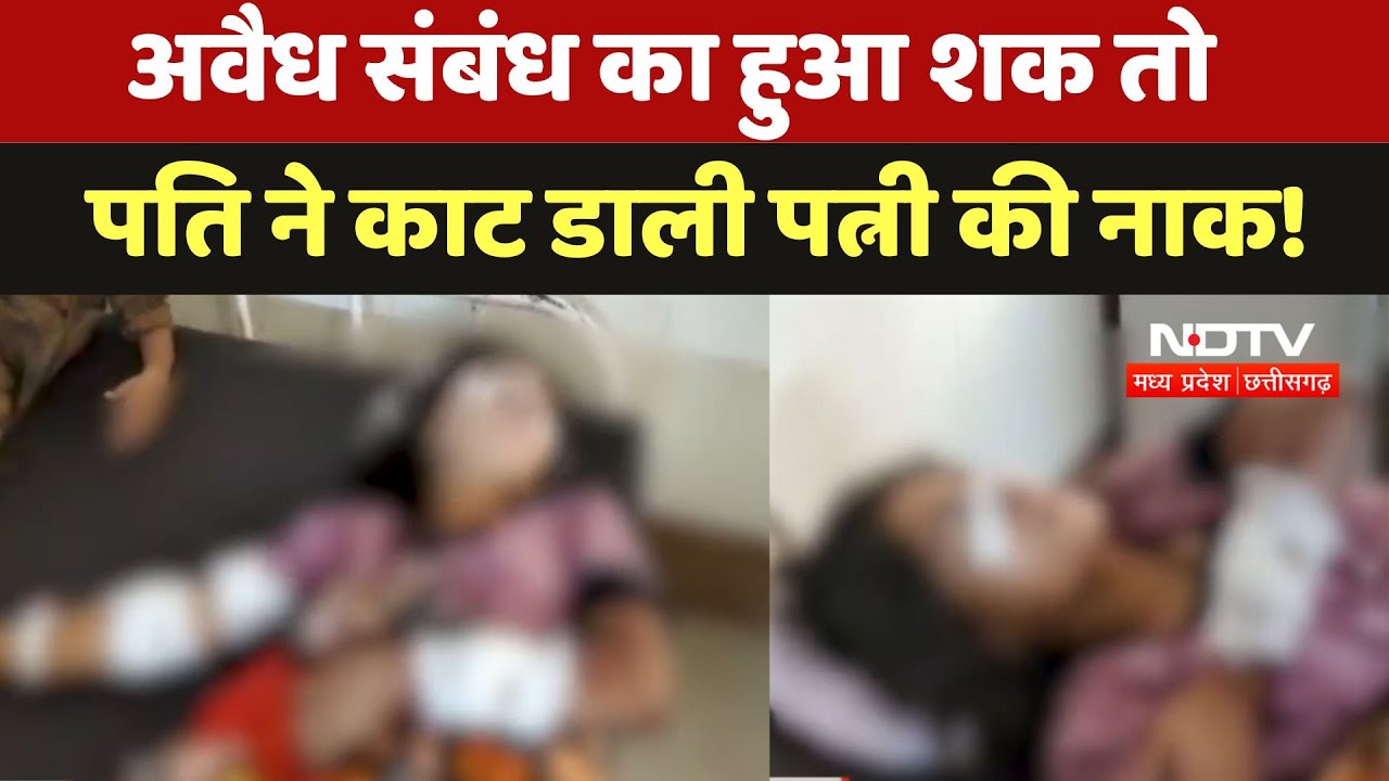 Morena Crime News: अवैध संबंध का हुआ शक तो पति ने काट डाली पत्नी की नाक!