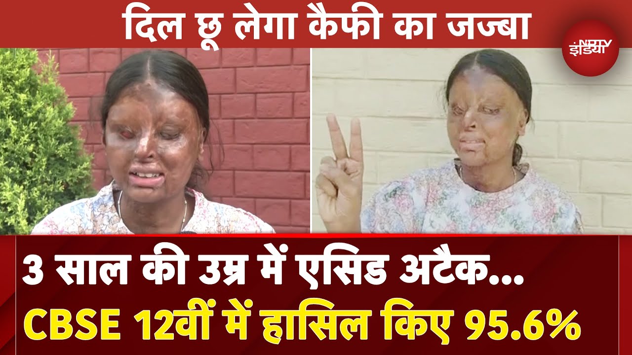 CBSE Topper 2025: 12वीं में 95.6% लाई इस Acid Attack Survivor की कहानी क्यों है खास? | CBSE Result