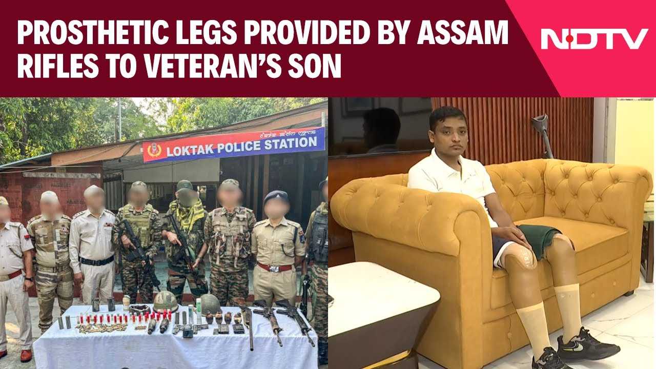 Assam News | Assam Rifles Fulfills Promise, Prosthetic Legs Provided To Veteran's Son